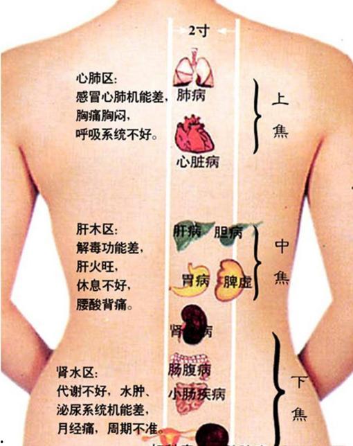 刮痧在线观看